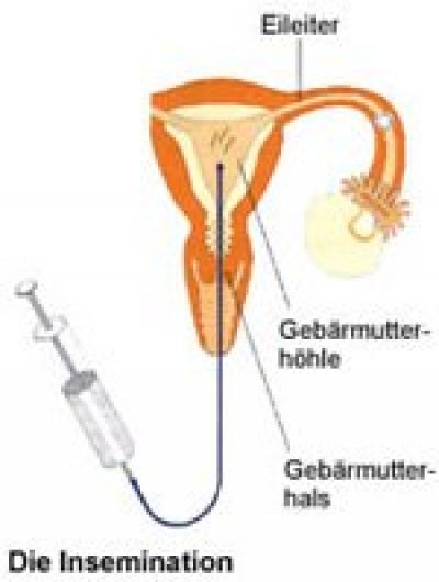 insemination grafik